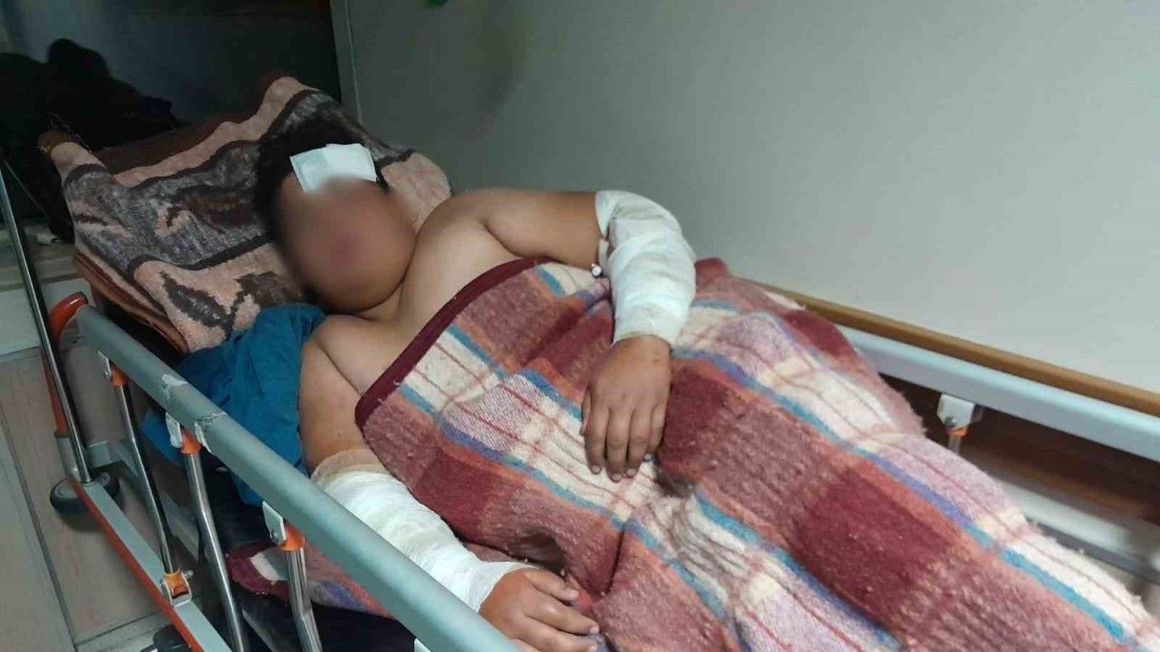 Konya’da köpeklerin kovaladığı çocuk bisikletten düşüp yaralandı